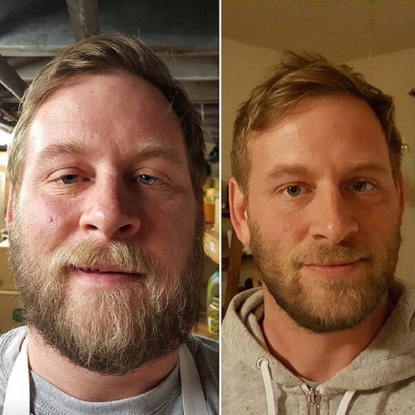appearance of the person before and after alcohol